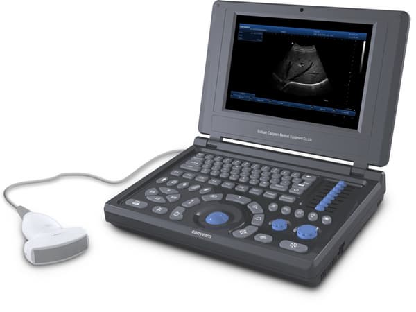 A10 Full Digital Laptop Ultrasonic Diagnostic System